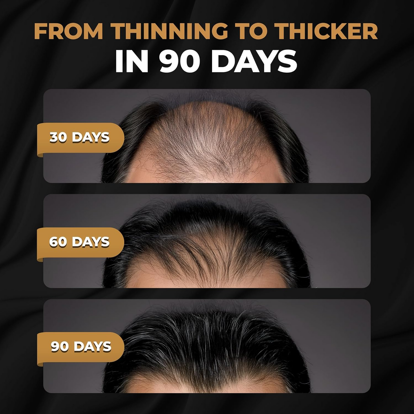 SPARTAN™ Root Activator Shampoo For Men Hair Loss - Increased Hair Growth with Just 4 Washes a Week*