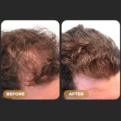SPARTAN™ Root Activator Shampoo For Men Hair Loss - Increased Hair Growth with Just 4 Washes a Week*